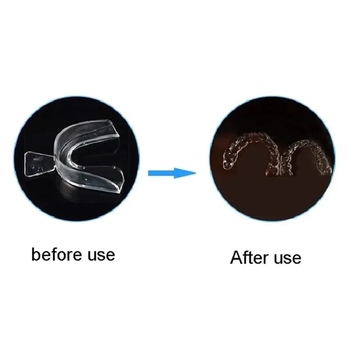 Anti-Snoring Mouth Guard Set Rieworkes