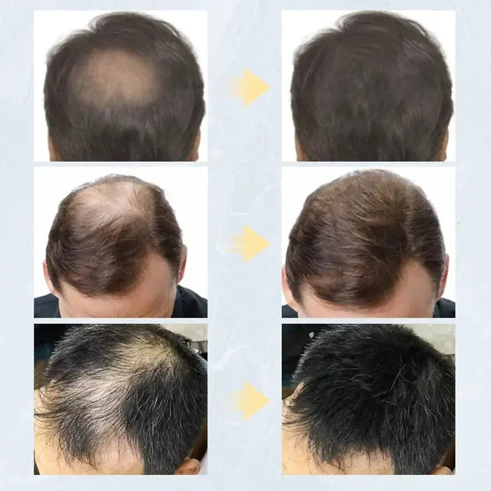 Keratin Hair Fibers Rieworkes