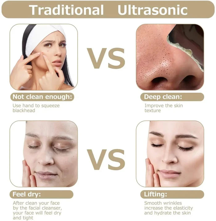 Ultrasonic Skin Scrubber Rieworkes